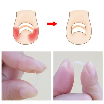 

10pcs Foot Care Recover Ingrown Straightening Tool Elastic Toenail Correction Patch Thin Pedicure Sticker Paronychia Treatment