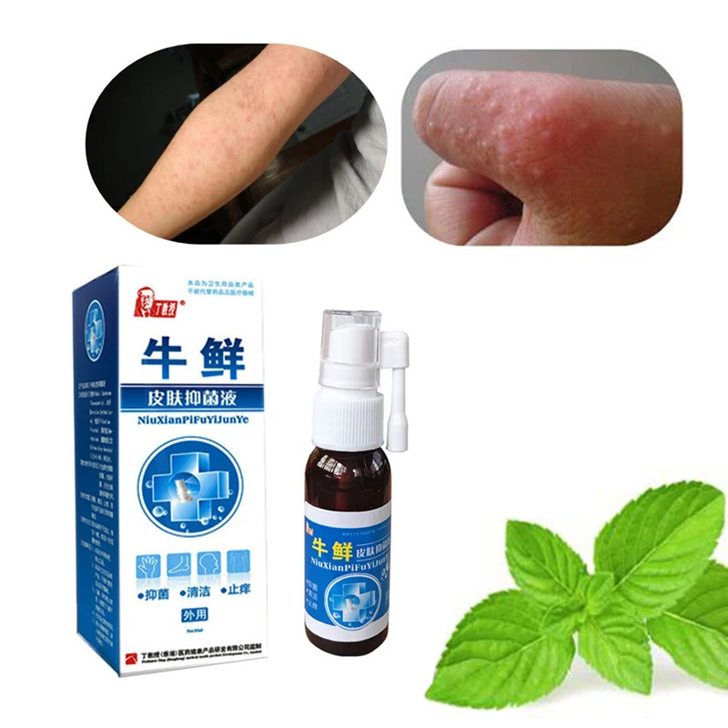 5 шт. крем для ухода за кожей от псориаза дерматит эцематоидная мазь |