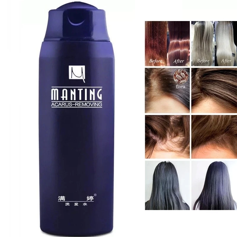 ManTing Professional Shampoo Divide Mite Anti-Itching Anti Dandruff Suitable No Silicone Oil Control for All Hair Types | Красота и