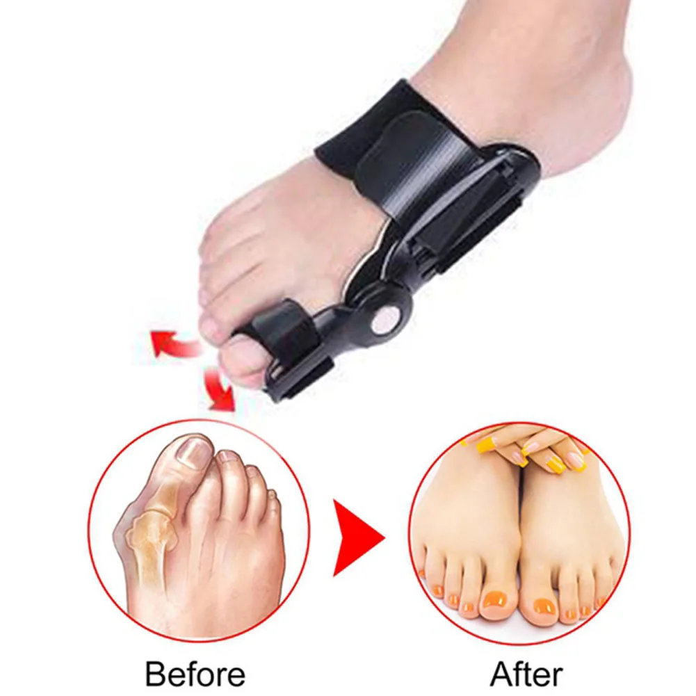 Pain Relief Foot Care Corrector Belt Correction Tool Bunion Splint Straightener Hallux Valgus Big Toe Foot Corrector Adjustable