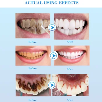

10ml Oral Hygiene Portable Toothpaste Teeth Bleaching Essence Smoke Cleaning Stains Remove Care Adult Dental Tools Serum Liquid