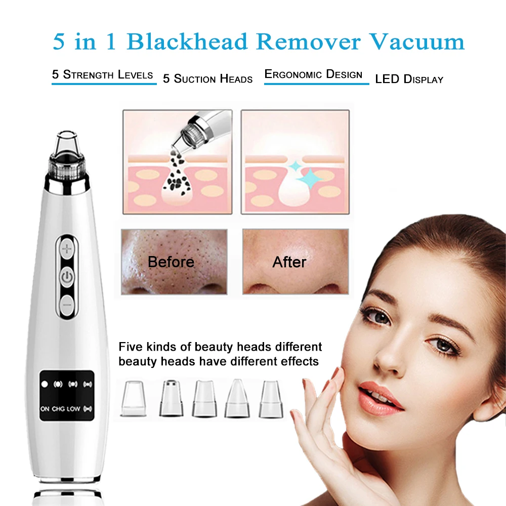 TinWong Blackhead Remover Vacuum,  Electric Facial Comedo Suction Pore Cleaner Extractor Tool,5 Replaceable Suction Heads
