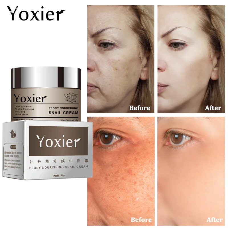 Yoxier Snail Eye Cream Face Cream Anti-aging Remove Eye Bag Lifting Firming Fine Lines Facial Skin Care Buy 2 Get 1 Free Gift-4