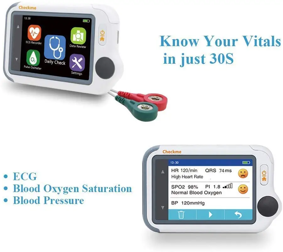 Portable Vital Signs Monitor with APP & PC Report ECG/EKG Monitor Pulse Oximeter Viatom Checkme Lit