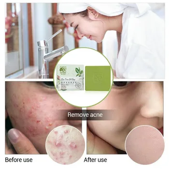 

Tea Tree Oil Soap Control Oil Anti-Acne Shrinking Pores Remove Pimples Mites Handmade Soap