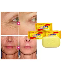 Ботаническое мыло лечение акне. Лечения псориаза. Акарида или угрицы. Свежая и блестящая кожа. Тонкое Лицо, тонкое тело и обезжиривающий лосьон для ванны