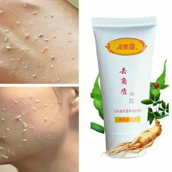

Exfoliating exfoliating gel de-kerated with dead skin body gel and skin care exfoliator Q0Q6