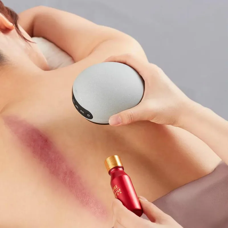 Youpin Leravan Electric Cupping Massage Scraping