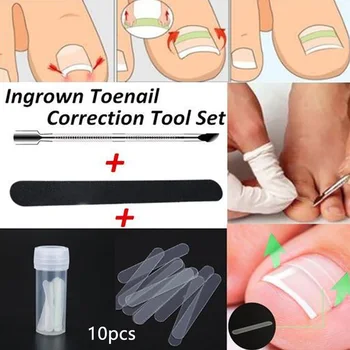

Portable Professional Tool Practical Pedicure Foot Care Correction Patch Kit Easy Apply Toenail Recover Straightening Home