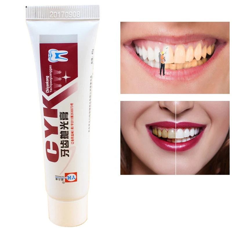 Teeth Polishing Paste Anti-Inflammatory Hemostasis Relieve Pain Teeth Whitening Cream P1