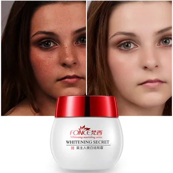 

Fonce Whitening Freckles Cream 30g powerful spot remover anti Aging Dark Spots Fade Beauty Face Cream