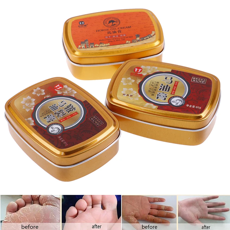 

Snake Oil Tender Cream Hand Care Antibacterial Skin Care Whitening Nourishing Skin Care Cream 80g