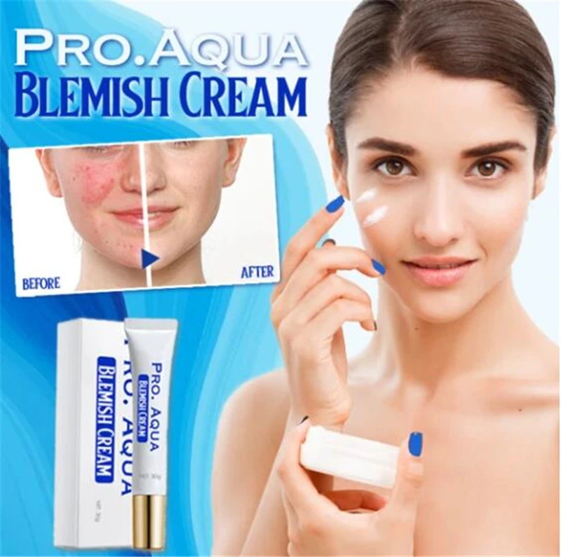 aqua acne cream