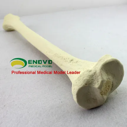 Simulation of artificial bone in the Department of orthopedics of the Sawbone artificial bone model  Department of orthopedics