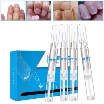 

4Pcs Fungal Nail Pen Effective Onychomycosis Paronychia Fungus Infection Repair Solution Gel Fingernails Toenails Plaster D042