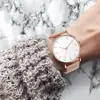 Lover's Watches