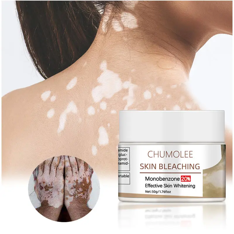 *Chumolee Face Whitening Cream Monobenzone Skin Bleaching White Spot