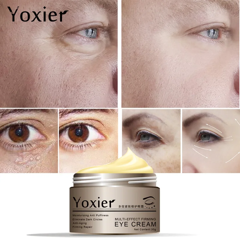 Yoxier Snail Eye Cream Face Cream Anti-aging Remove Eye Bag Lifting Firming Fine Lines Facial Skin Care Buy 2 Get 1 Free Gift-3