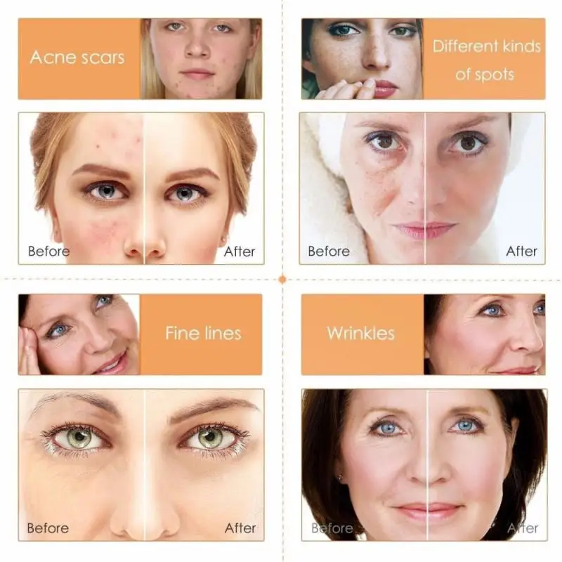 30ML Natural Vitamin C Serum Liquid Hyaluronic Acid Essence Moisturizng Anti Aging Anti Wrinkle Serum for Skincare TSLM2 30ML Natural Vitamin C Serum Liquid Hyaluronic Acid Essence Moisturizng Anti Aging Anti Wrinkle Serum for Skincare TSLM2