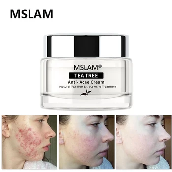 

MSLAM Tea Tree Acne Treatment Face Cream Repair Gel Oil Control Shrink Pore Scar Blackhead Moisturized Fade Acne Mark Face Care