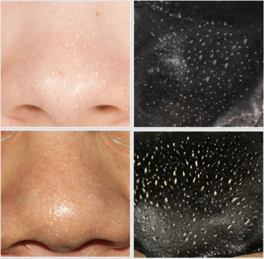 1 - YJL61107762_20161107105658987