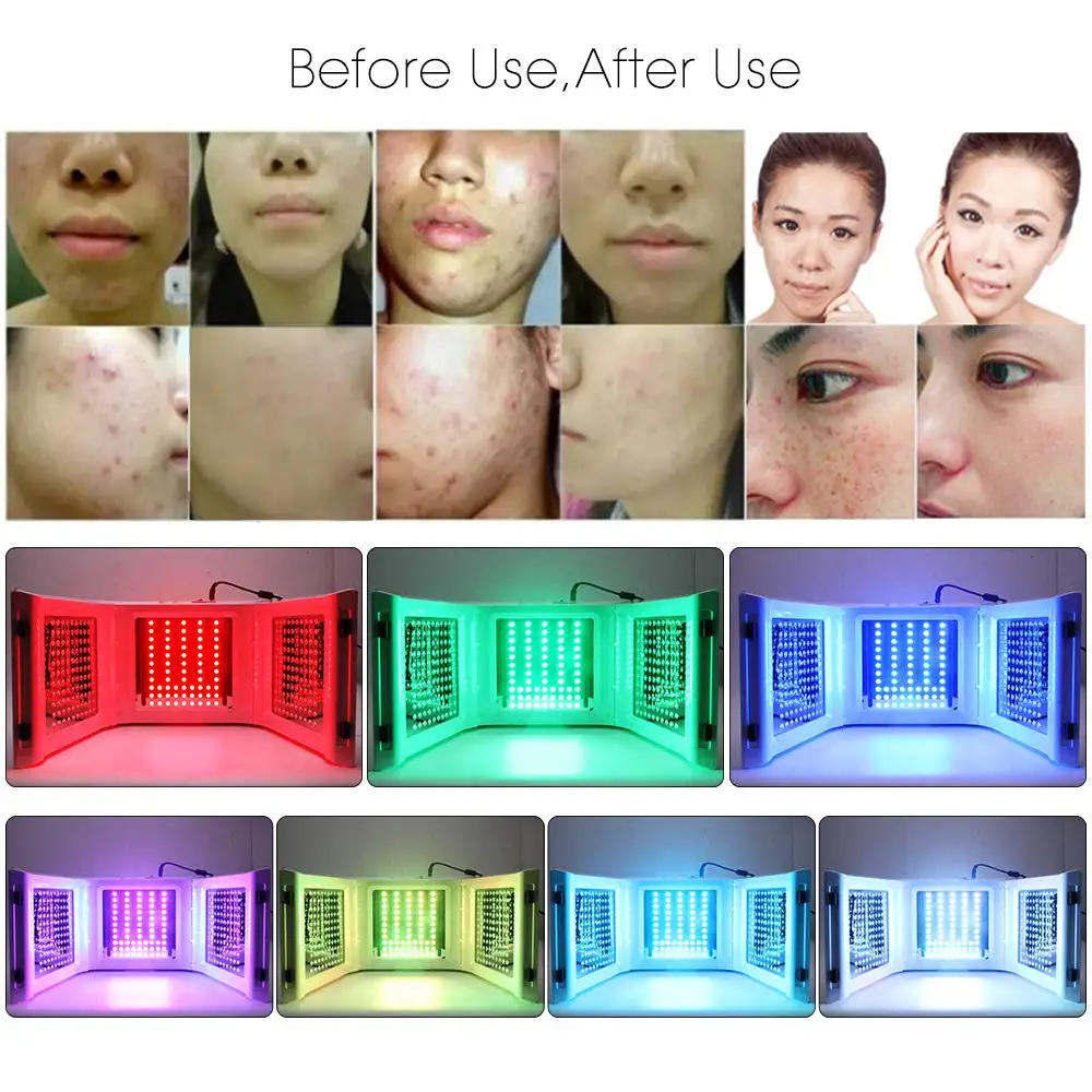 71MDFPMiiJL._SL1000_