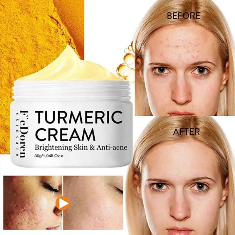 

30g Herbal Turmeric Face Cream Anti-aging Wrinkle Fade Freckles&Dark Spots Exfoliating Facial Mask Moisturizing Whitening Face A