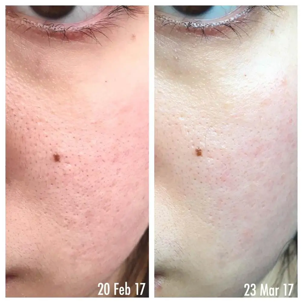 H5bce5381247f4e8490a67fb3d4e1e35cJ Pixi 100ML 5% Glycolic Acid Moisturizing Oil-controlling Lift Anti-acne Essence For Women Skin Care Facial Repair Makeup Toner