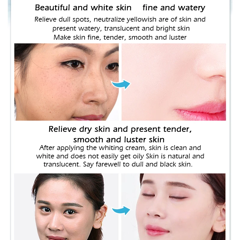 Whitening Facial Cream Hydrating Moisturizing Remove Acne Spot Shrink Pores Day Cream Deep Cleansing Oil Control 4