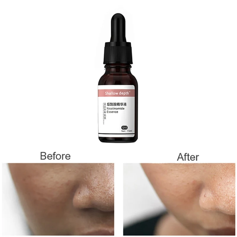 Nicotinamide Essential Liquid Moisturizing Nourishing Shrinking Pores Brighten Skin Tone Nicotinamide Serum Face Essence 15ml