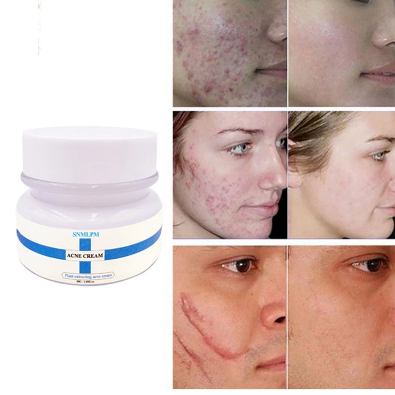 snmlpm freckle cream