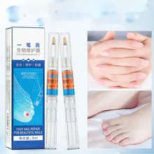 Антибактериальный Уход за ногтями грибковая ручка для лечения Ногтей Onychomycosis Paronychia жидкая бактериостатная ручка для ухода за ногтями 3 мл