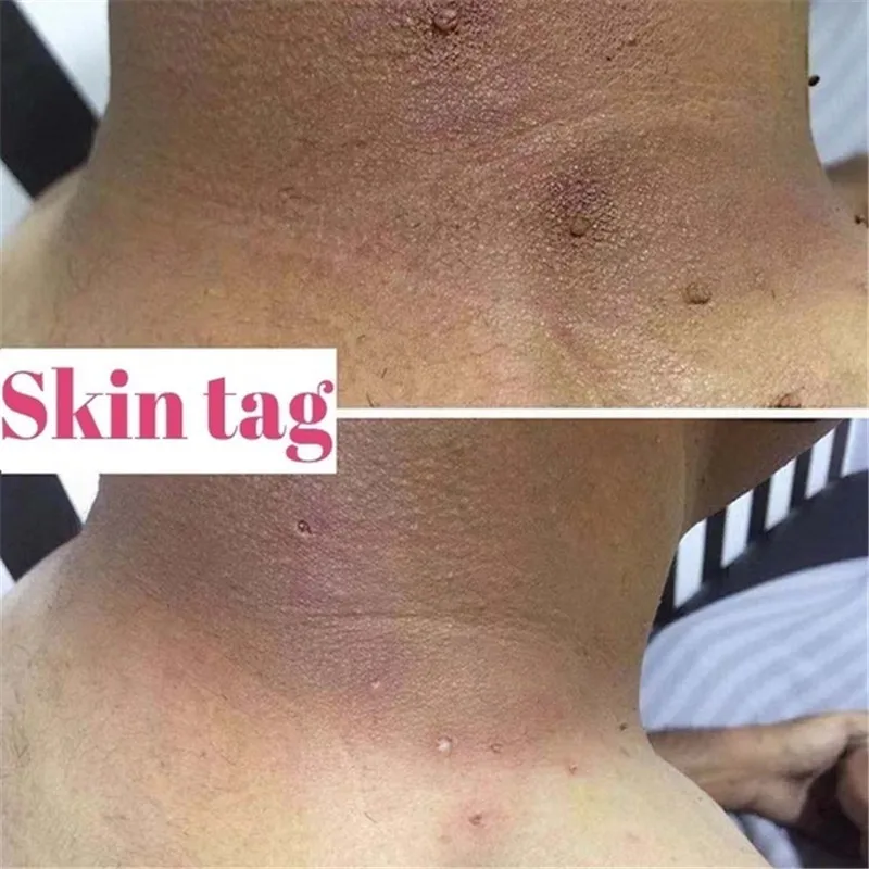 5db40a56a97a880cb62ff37a-4-large