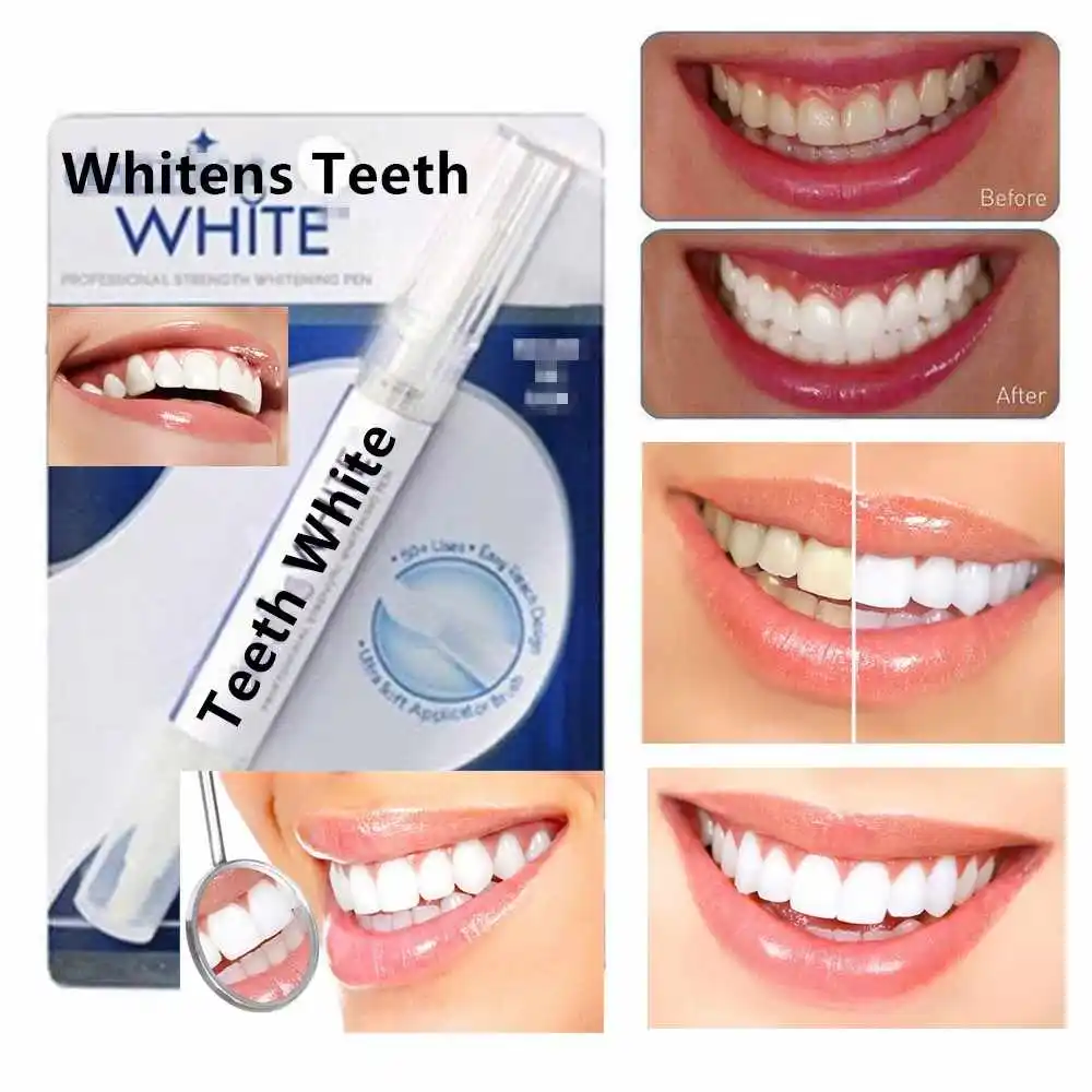 

1pcs Dental Teeth Whitening Tooth Cleaning Rotary Peroxide Bleaching Kit Dental Dazzling White Teeth Whitening Pen