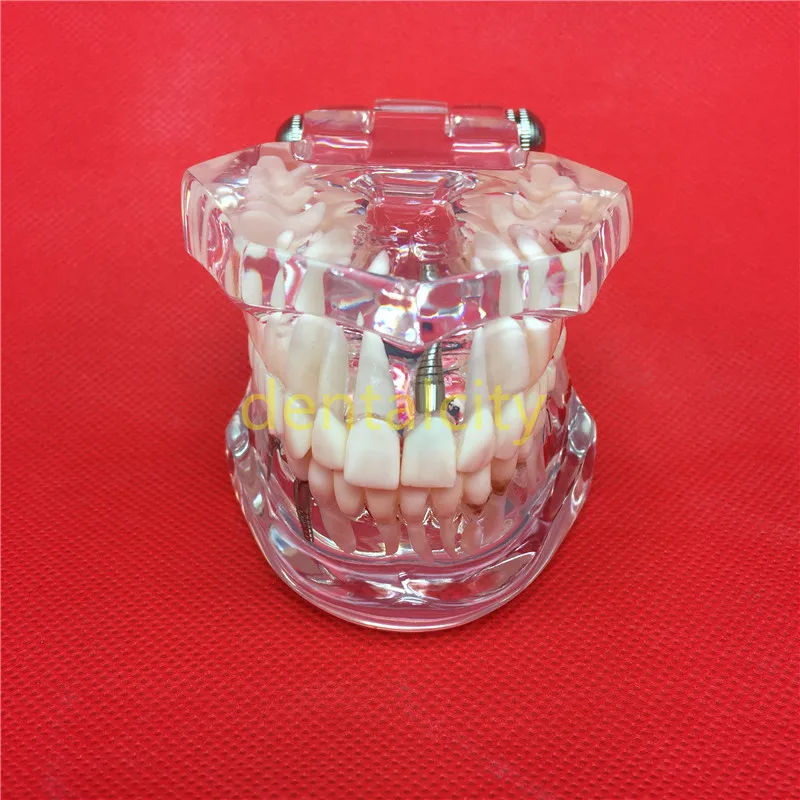 Фото Стоматологические модели зубов используются для обучения и | Стоматологическая учебная модель (32949795402)