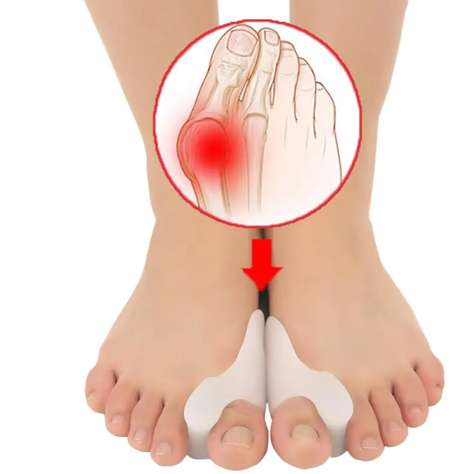 Thumb-Valgus-Protector Feet-Care Foot-Fingers Silicone Pro-Guard Bunion Adjuster Hallux