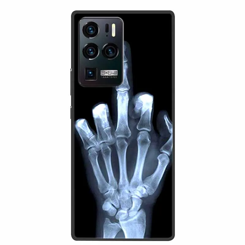 Shockproof Soft Silicone TPU Back Cover - Cute Design