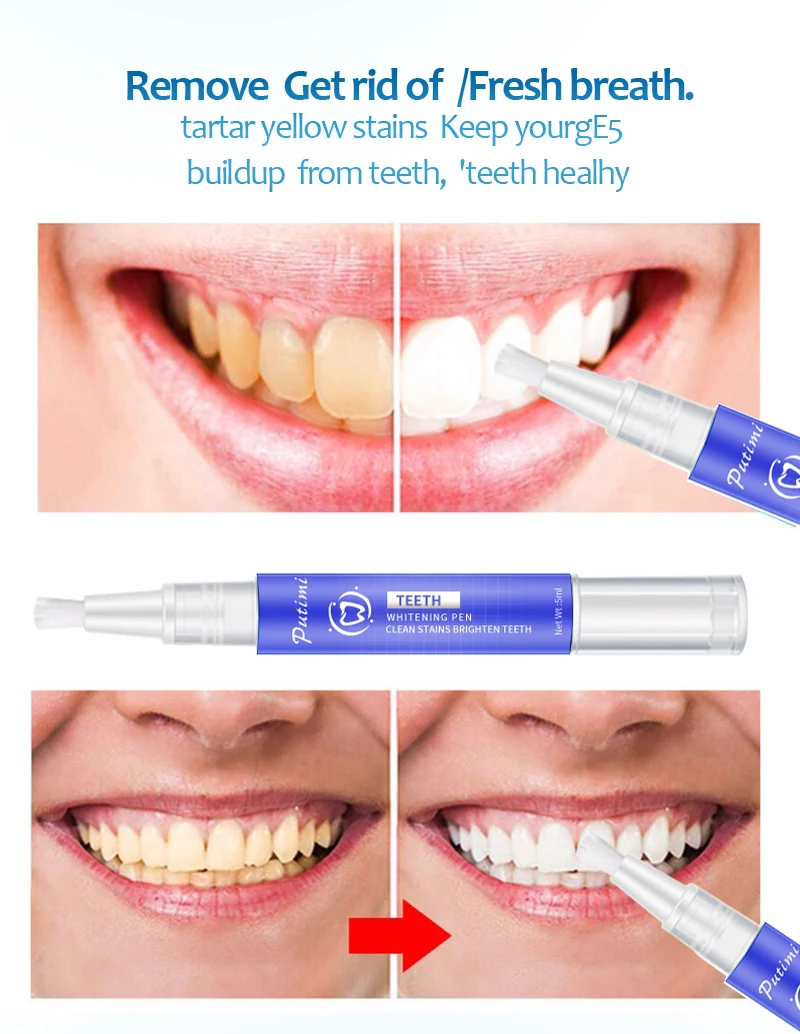 White Teeth Whitening Gel Pen Dental Dentist Dentistry Tooth Gel Whitener Bleach Remove Stains Oral Hygiene 4