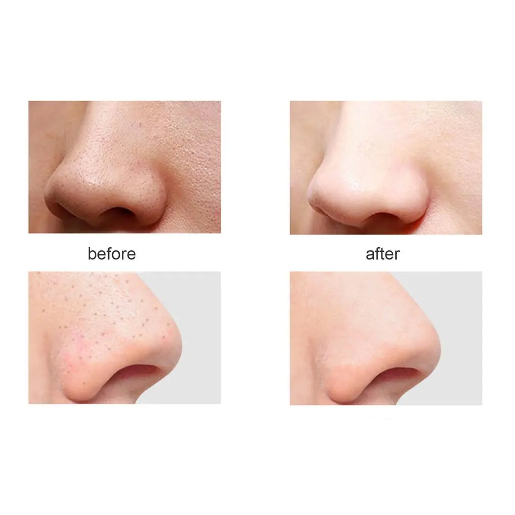 Blackhead Instrument Electric Cleansing Pore Cleaner Acne Facial Beauty To Blackhead Instrument Beauty Products 2