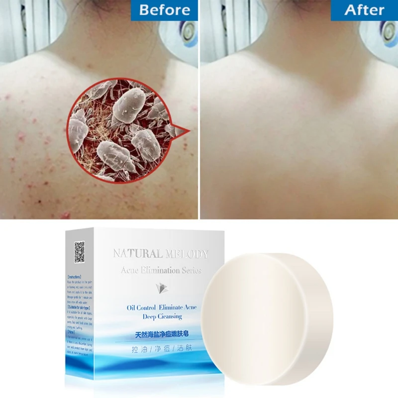 

100g Anti-acnes Anti-mite Handmade Sea Salt Soap Nourishing Moisturizing Skin Oil-control Soap Face Washing Product