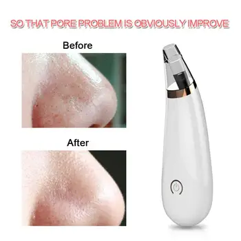 

Face Cleaner Black Head Removal Acne Removing Apparatus 3 Treatment Heads Magic Fashion Effective Massager Deep Clean