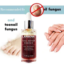 Пилочка для удаления ногтей, эссенция для восстановления ногтей с пилочкой Wmall для ногтей, питающая грибковый наконечник, осветляющая жидкость для ремонта ногтей, принадлежности для ремонта ногтей