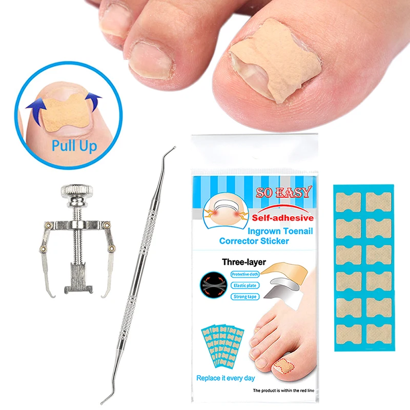 Ingrown Toe Nails Correction Pedicure Foot Toe Nail Care Tools File Elastic Patch Straightening Clip Brace Corrector Wire Fixer