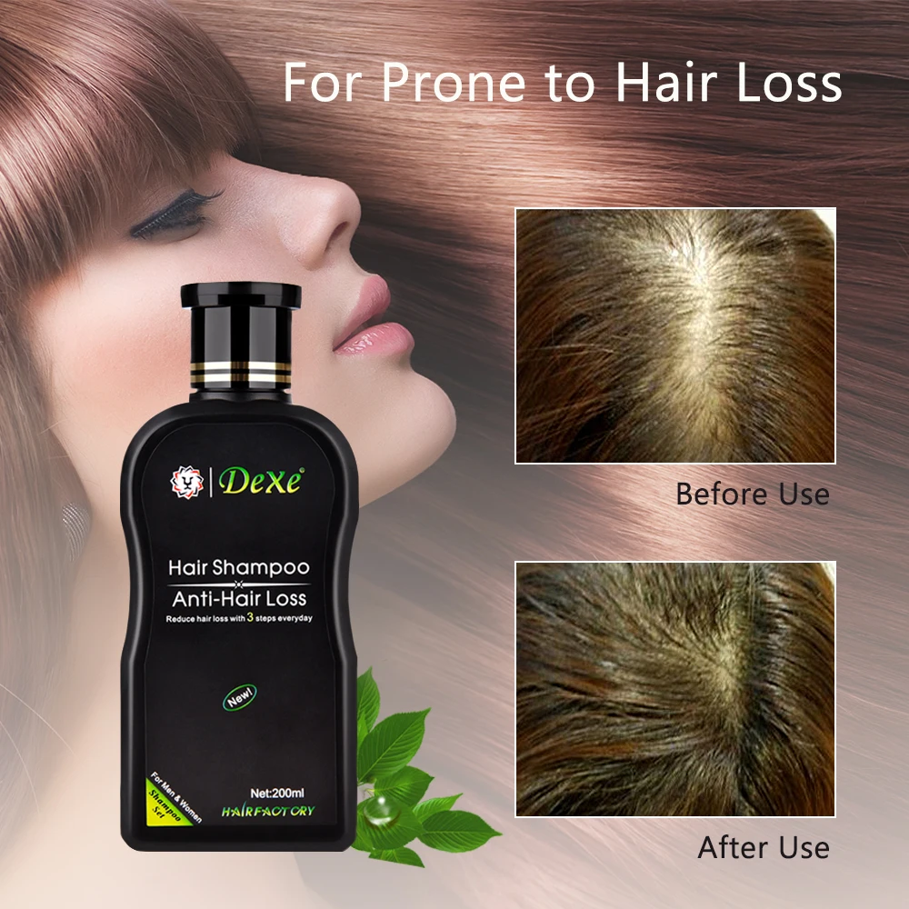 200ml Hair Growth Shampoo Anti Hair Loss Shampoo Regrowth Chinese Herbal Ginger Hair Repair Prevent Product Hair Loss Treatment