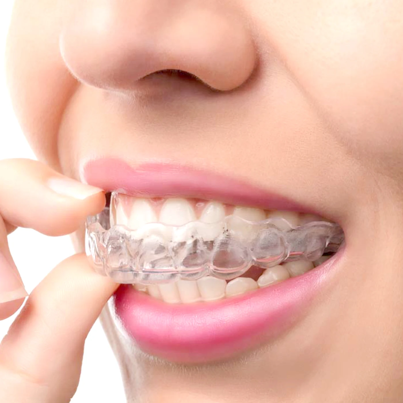 Anti Snoring Mouth Guard Bruxism Mouth Guard Anti Snore Mouthpiece