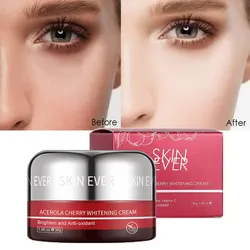 Whitening Freckle Cream Remove Melasma Improve Dullness Fade Dark Spots Melanin Melasma Remover Brighten Skin Care Lightening