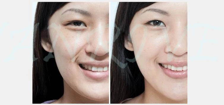 36020170903163453825