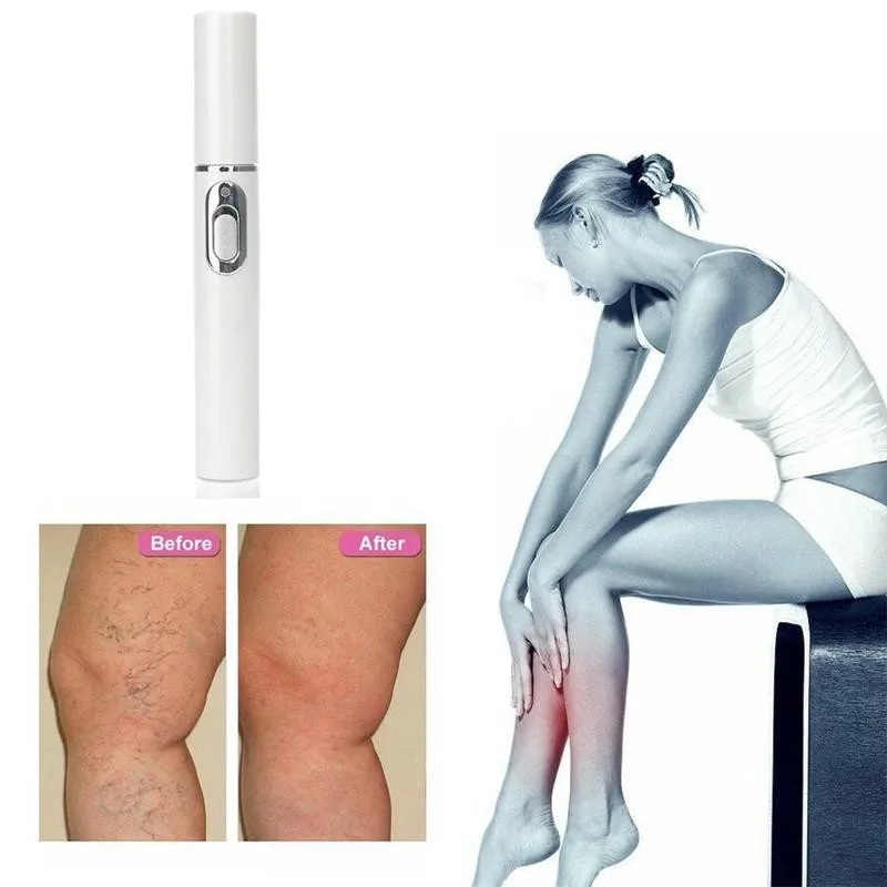 Blue Light Therapy Varicose Vein Pen Medical Varicose Scar Vein Pen Light Blue Acne Therapy Treatment P0R3 5