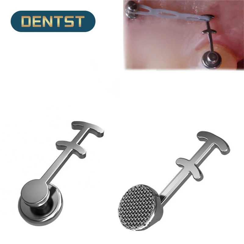 50pcs Dental Orthodontic Lingual Button Bondable Power Arms Adhesive