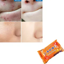 Сульфатное мыло Шанхай лечение акне угрей Удаление пор мыло Отбеливающее масло для лица Косметическое Мыло TSLM2